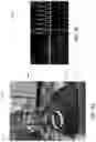 Fig. 11 - LESS INVASIVE AND IMPROVED PERIPHERAL NERVE STIMULATORS FOR OBSTRUCTIVE SLEEP APNEA AND OTHER APPLICATIONS