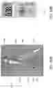 Fig. 12 - LESS INVASIVE AND IMPROVED PERIPHERAL NERVE STIMULATORS FOR OBSTRUCTIVE SLEEP APNEA AND OTHER APPLICATIONS