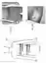 Fig. 17 - LESS INVASIVE AND IMPROVED PERIPHERAL NERVE STIMULATORS FOR OBSTRUCTIVE SLEEP APNEA AND OTHER APPLICATIONS