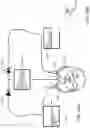 Fig. 23 - LESS INVASIVE AND IMPROVED PERIPHERAL NERVE STIMULATORS FOR OBSTRUCTIVE SLEEP APNEA AND OTHER APPLICATIONS