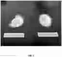 Fig. 02 - REACTIVE GRANULATION OF CALCIUM CITRATE MALATE, DICALCIUM MALATE, AND DIMAGNESIUM MALATE