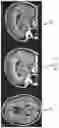 Fig. 02 - Machine learning processing of contiguous slice image data