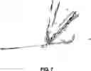 Fig. 08 - MULTI-MATERIAL DECOMPOSITION FOR SPECTRAL COMPUTED TOMOGRAPHY