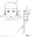 Fig. 02 - METHOD AND DEVICE FOR PROCESSING A BINAURAL RECORDING