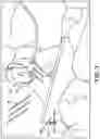 Fig. 04 - Pillow Divider Device