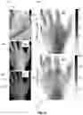 Fig. 13 - STRUCTURED-LIGHT IMAGING SYSTEMS AND METHODS FOR DETERMINING SUB-DIFFUSE SCATTERING PARAMETERS
