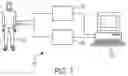 Fig. 02 - INTRAPROCEDURAL AUTOMATED SYSTEM FOR LOCALIZING IDIOPATHIC VENTRICULAR ARRHYTHMIA ORIGINS