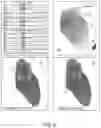 Fig. 07 - INTRAPROCEDURAL AUTOMATED SYSTEM FOR LOCALIZING IDIOPATHIC VENTRICULAR ARRHYTHMIA ORIGINS