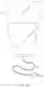 Fig. 04 - Circumferential Retractor System