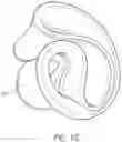Fig. 15 - Circumferential Retractor System