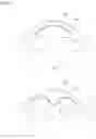 Fig. 02 - NASAL PROSTHESIS AND RHINOPLASTY METHOD USING THE SAME