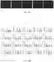 Fig. 49 - NUCLEIC ACID SEQUENCING USING EVANESCENT WAVE IMAGING