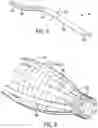 Fig. 08 - Pressure modulating multi-diameter thrust cup arrangement and positioning system