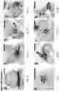 Fig. 09 - ALL-OPTICAL VISUALIZATION OF SPECIFIC MOLECULES IN THE ULTRASTRUCTURAL CONTEXT OF BRAIN TISSUE