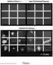 Fig. 02 - METHODS AND KITS FOR DIAGNOSING COVID-19 DISEASE