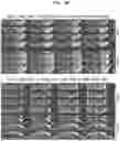 Fig. 16 - Highly Accelerated Sub-Millimeter Resolution 3D GRASE with Controlled T2 Blurring in T2-Weighted Functional MRI at 7 Tesla
