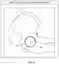 Fig. 07 - System and method for analyzing acetabular cup position