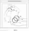 Fig. 09 - System and method for analyzing acetabular cup position