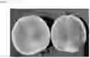 Fig. 02 - PARTHENOCARPIC WATERMELON PLANTS