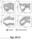 Fig. 08 - METHODS AND AGENTS FOR TREATING, PREVENTING, DIAGNOSING, AND EVALUATING THERAPY FOR FIBROTIC, AUTOIMMUNE, AND INFLAMMATORY CONDITIONS