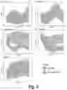 Fig. 09 - METHODS AND AGENTS FOR TREATING, PREVENTING, DIAGNOSING, AND EVALUATING THERAPY FOR FIBROTIC, AUTOIMMUNE, AND INFLAMMATORY CONDITIONS