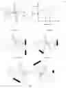 Fig. 02 - DETECTION DEVICE, SYSTEM AND METHOD FOR DETERMINATION OF INCIDENCE ANGLE OF AN OPTICAL BEAM