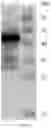 Fig. 06 - INDIRECT ENZYME-LINKED IMMUNOSORBENT ASSAY DETECTION KIT BASED ON P30 PROTEIN AND P22 PROTEIN OF AFRICAN SWINE FEVER VIRUS