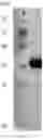 Fig. 07 - INDIRECT ENZYME-LINKED IMMUNOSORBENT ASSAY DETECTION KIT BASED ON P30 PROTEIN AND P22 PROTEIN OF AFRICAN SWINE FEVER VIRUS