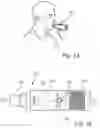 Fig. 02 - A COLLECTING DEVICE FOR COLLECTION OF PARTICLES, A SAMPLE COLLECTOR, AND AN ANALYSIS INSTRUMENT