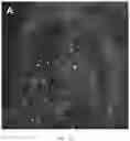 Fig. 02 - METHODS FOR NON-INVASIVE, LABEL-FREE IMAGING OF CELLULAR IMMUNE RESPONSE IN HUMAN SKIN USING A NONLINEAR OPTICAL MICROSCOPY IMAGING SYSTEM