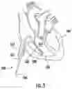 Fig. 07 - LEAD AND MEDICAL USE THEREOF