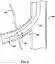 Fig. 08 - Methods and devices for endovascular ablation of a splanchnic nerve