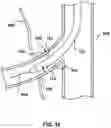 Fig. 09 - Methods and devices for endovascular ablation of a splanchnic nerve