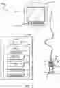 Fig. 02 - Ultrasound Imaging Device with Automatic Adjusting Needle Guide