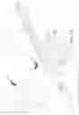Fig. 02 - INTRAOCULAR LENS FIXATION DEVICE