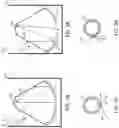Fig. 02 - Low noise optothermally stable metering structure
