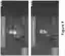 Fig. 07 - METHOD AND SYSTEM FOR 2D MOTION TRACKING OF A SUBJECT