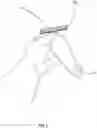 Fig. 02 - Emergency Protocol Receptacle for Puncture Wounds