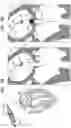Fig. 06 - Prosthetic heart valve