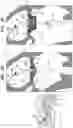Fig. 08 - Prosthetic heart valve