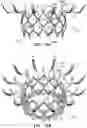Fig. 14 - Prosthetic heart valve