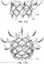 Fig. 15 - Prosthetic heart valve