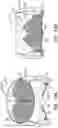 Fig. 18 - Prosthetic heart valve