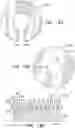 Fig. 19 - Prosthetic heart valve