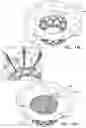Fig. 21 - Prosthetic heart valve