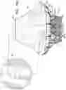 Fig. 22 - Prosthetic heart valve