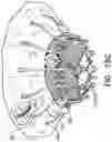 Fig. 24 - Prosthetic heart valve