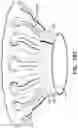 Fig. 27 - Prosthetic heart valve