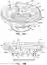 Fig. 29 - Prosthetic heart valve