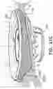 Fig. 34 - Prosthetic heart valve